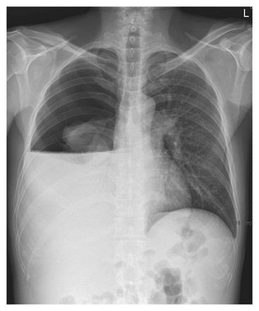 NEJM1